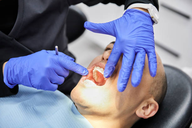 Best Emergency Root Canal Treatment in Marbleton, WY